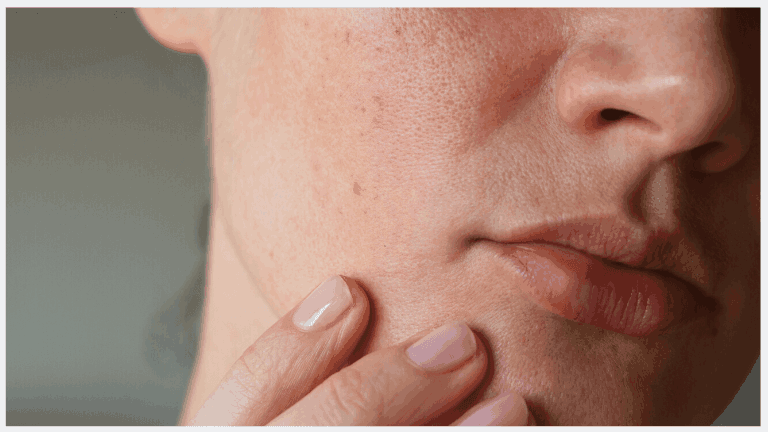 Sensitive Skin: Tips to healing